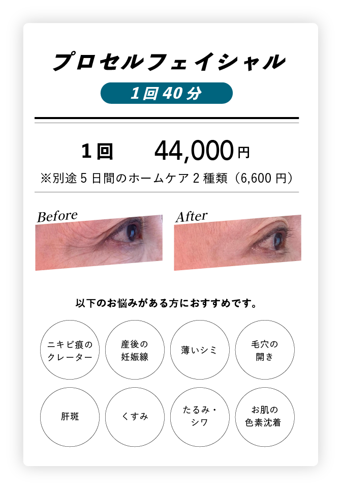 プロセルフェイシャル 1回40分
