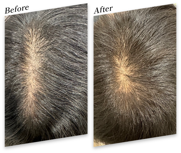40代 女性 2回 Before After