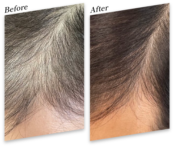 30代 男性 2回 Before After