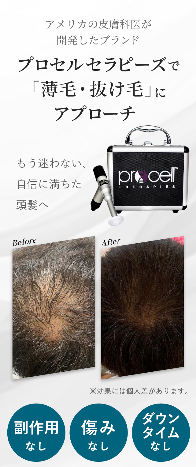 プロセルセラピーズ「薄毛・抜け毛」アプローチ