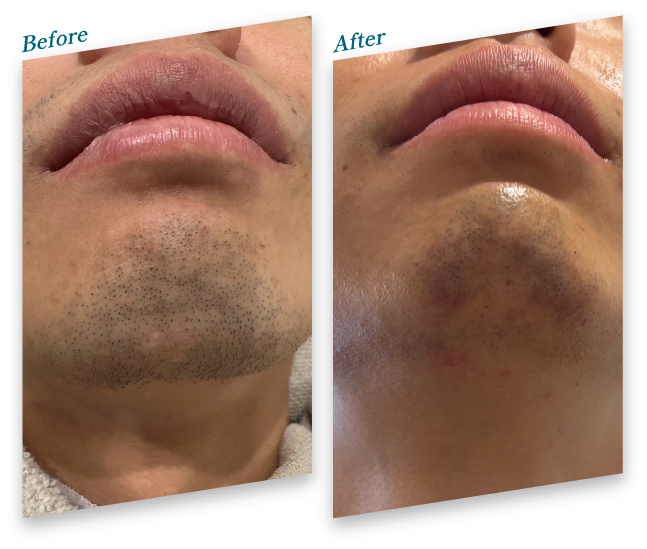 Before After